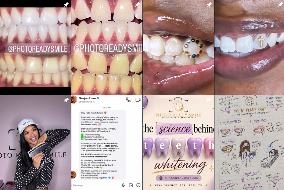 the best Teeth Whitening in Manhattan nyc